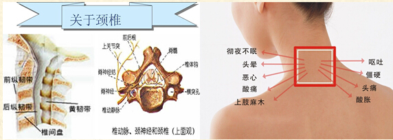 关于颈椎5.jpg