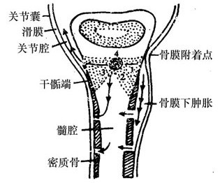 发病机理