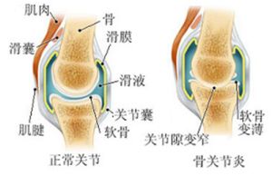 关节1.jpg