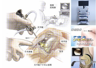 关节5.jpg